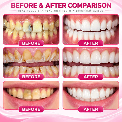 DenPerm Cavity-Repair Natural Enamel Filling Gel
