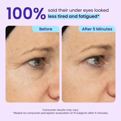 Lovqo™ Instant Lift Eye Gel
