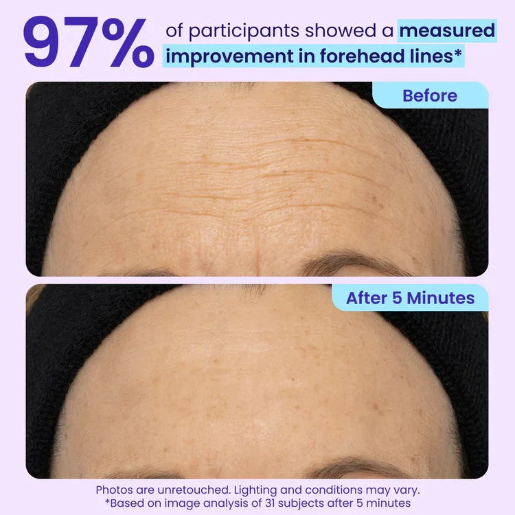 Lovqo™ Instant Lift Eye Gel