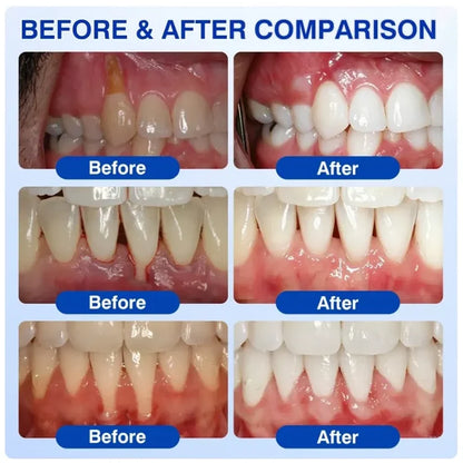 GumRevive Periodontal Care Gel-up