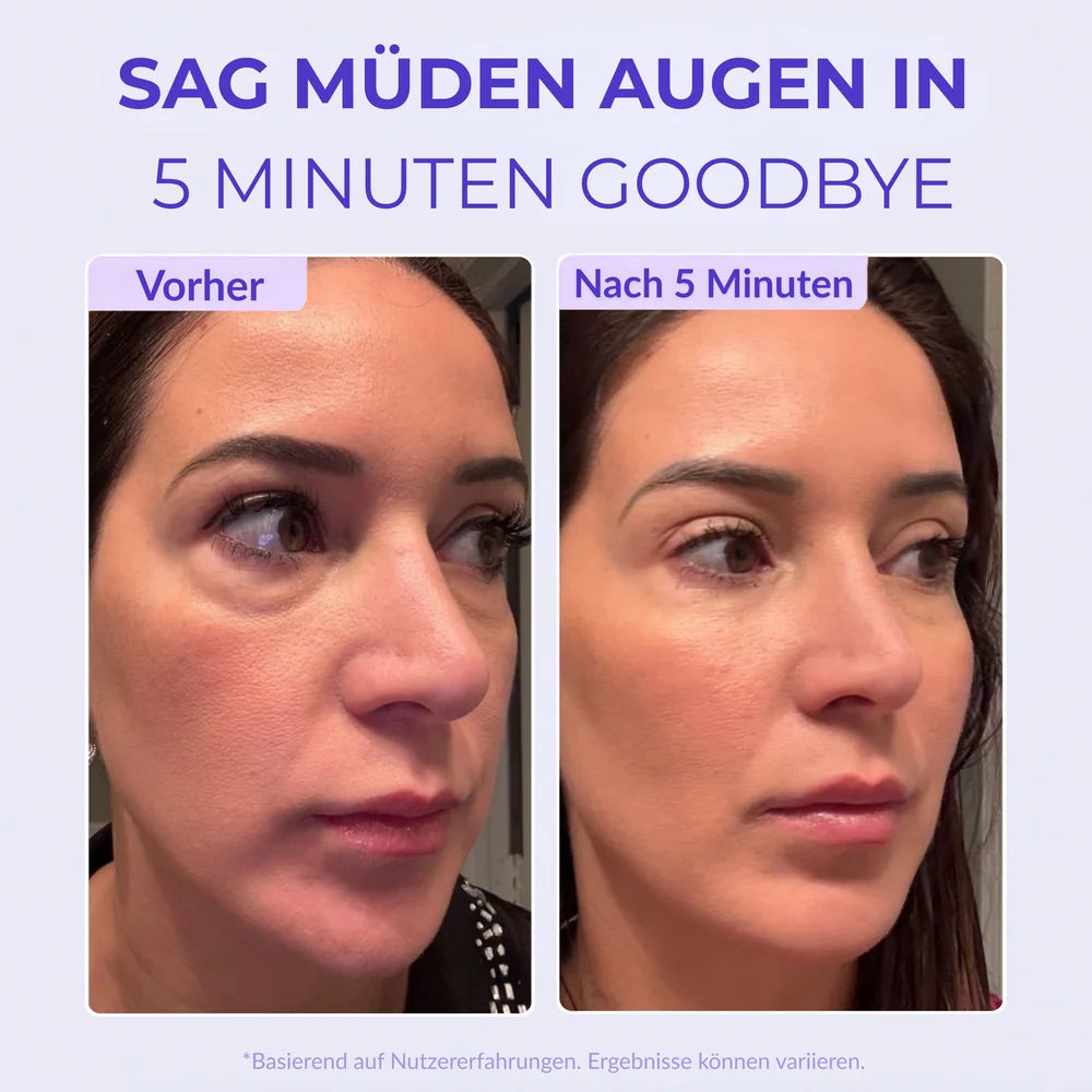Lovqo™ Instant Lift Eye Gel