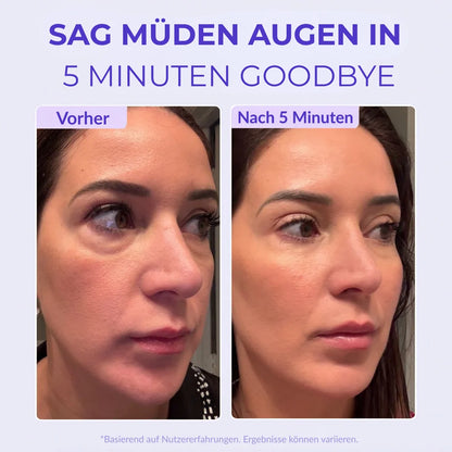 Lovqo™ Instant Lift Eye Gel
