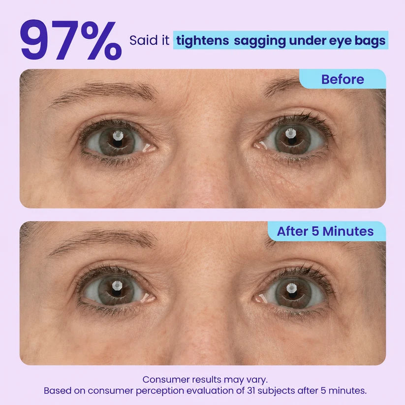 Lovqo™ Instant Lift Eye Gel