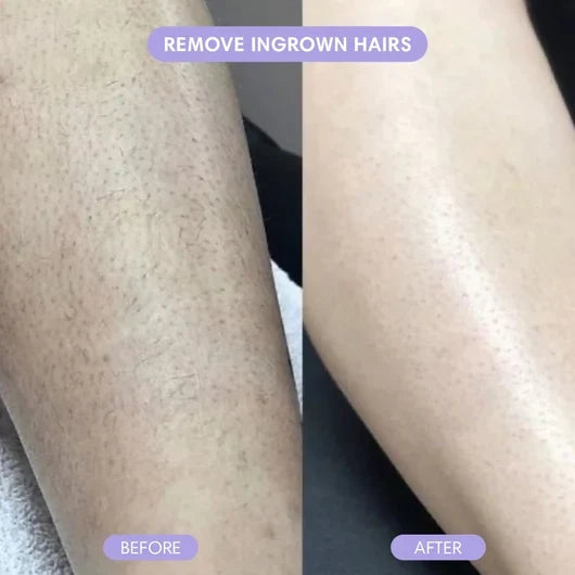 Bikini Pain-Free Hair Removal Cream for Sensitive Skin, Hypoallergenic Formula-Gentle